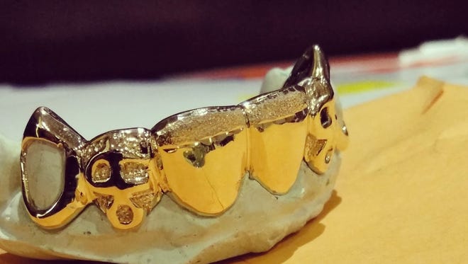 An example of what Delaware Custom Grillz does.