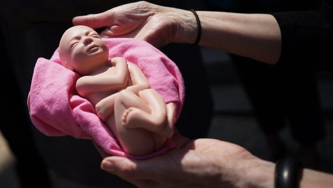 An anti-abortion activist holds a model of a fetus during a protest May 7, 2015, outside of the Longworth House Office Building on Capitol Hill in Washington.